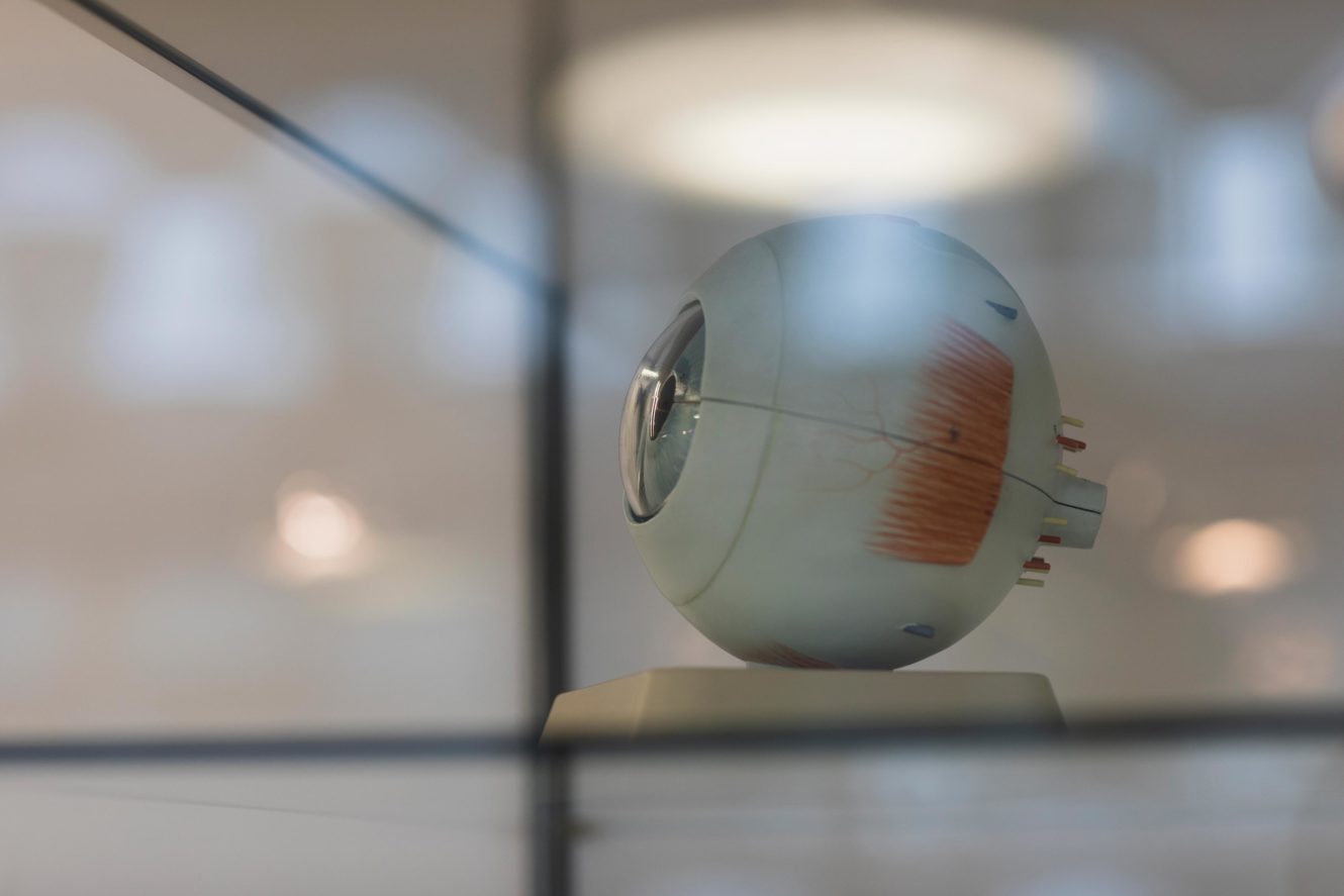 Poster für Video ALLY™ System: Einschnitte und Fragmentierungsmuster 