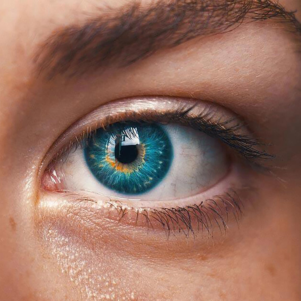 Augenlasern Dresden: (Femto) Lasik, ReLeX Smile, PRK/Lasek im Vergleich zur implantierbaren Kontaktlinse (ICL)